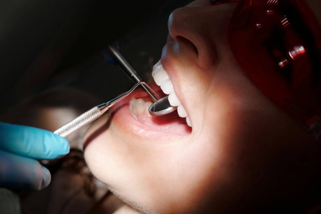 Canadian Dental Care Plan