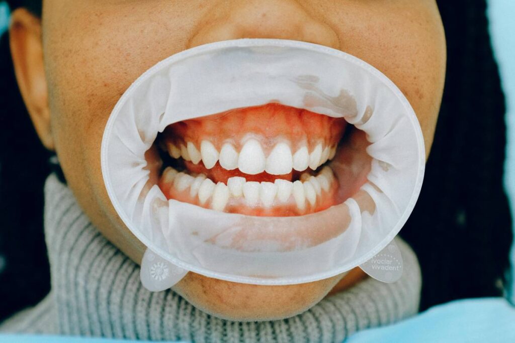 Canadian Dental Care Plan